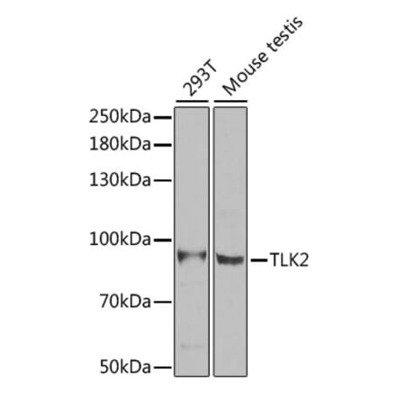 Western Blot - Anti-TLK2 Antibody (A15369) - Antibodies.com