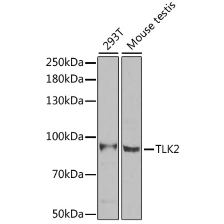 Western Blot - Anti-TLK2 Antibody (A15369) - Antibodies.com