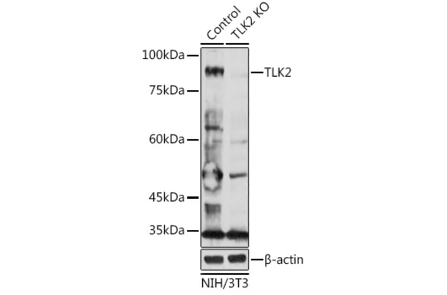 Western Blot - Anti-TLK2 Antibody (A15369) - Antibodies.com