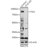 Western Blot - Anti-TLK2 Antibody (A15369) - Antibodies.com