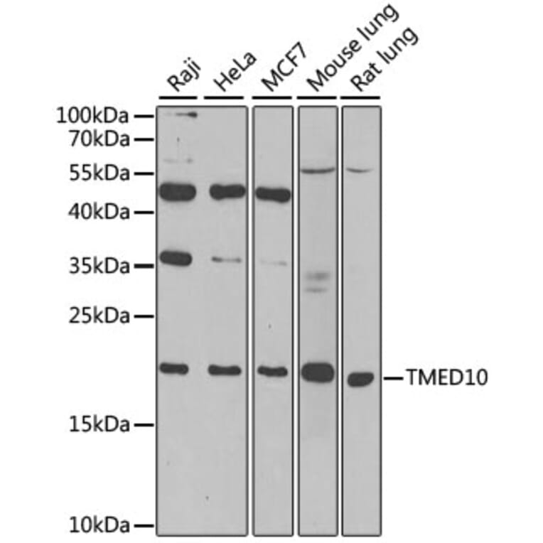 Western Blot - Anti-TMED10 Antibody (A6771) - Antibodies.com