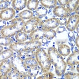 Immunohistochemistry - Anti-TMED10 Antibody (A6771) - Antibodies.com
