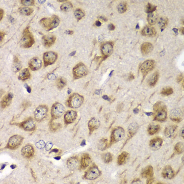 Immunohistochemistry - Anti-TMED10 Antibody (A6771) - Antibodies.com