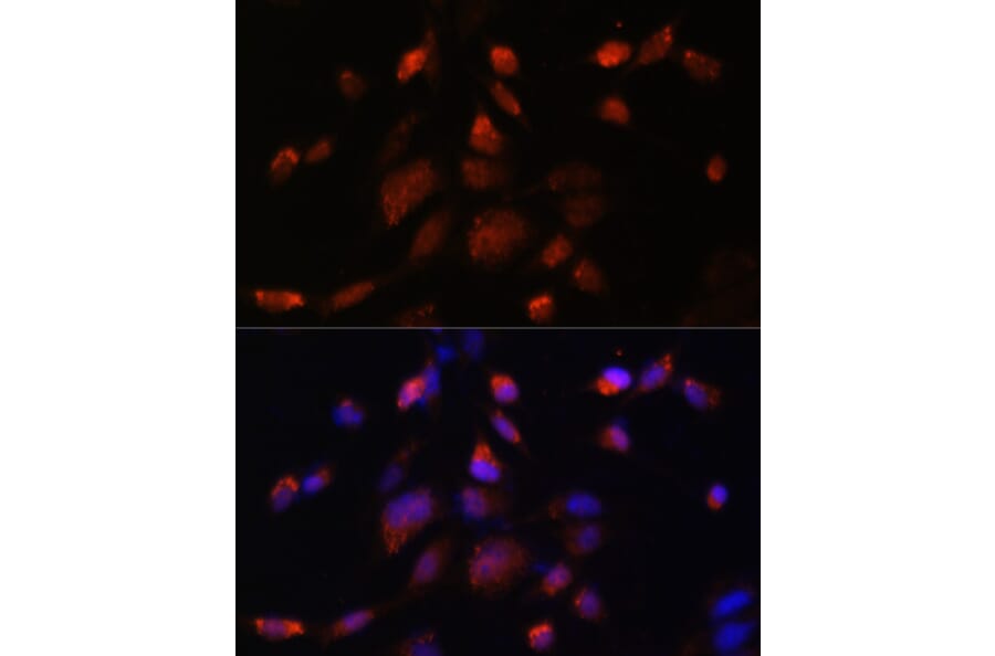 Immunofluorescence - Anti-TMED10 Antibody (A6771) - Antibodies.com