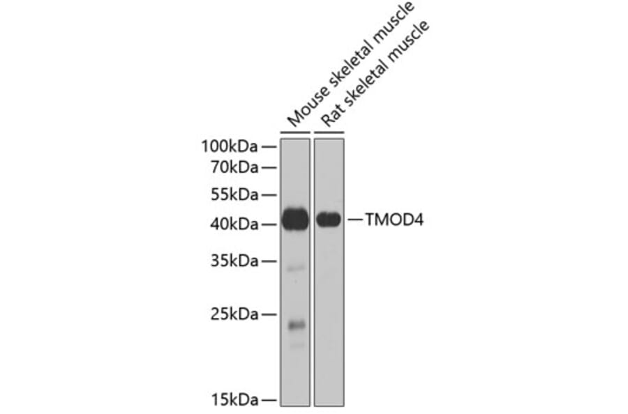 Western Blot - Anti-TMOD4 Antibody (A15371) - Antibodies.com