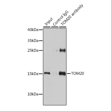 Western Blot - Anti-TOMM20 Antibody (A15372) - Antibodies.com