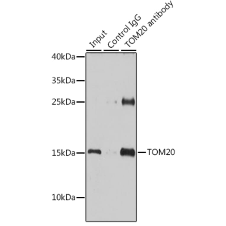 Western Blot - Anti-TOMM20 Antibody (A15372) - Antibodies.com
