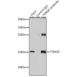 Western Blot - Anti-TOMM20 Antibody (A15372) - Antibodies.com