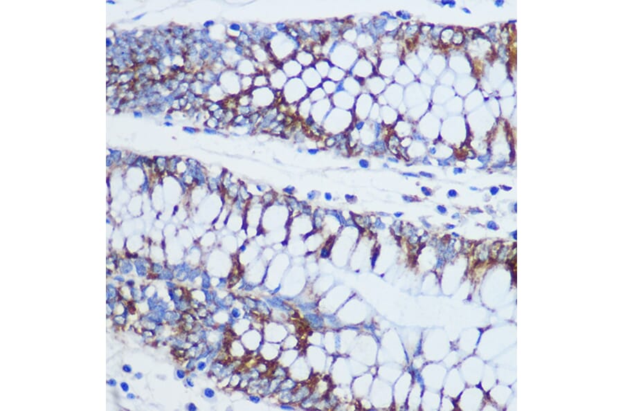 Immunohistochemistry - Anti-TOMM20 Antibody (A15372) - Antibodies.com