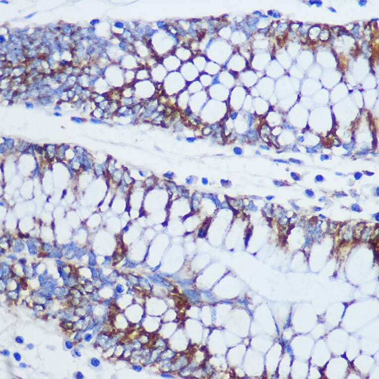 Immunohistochemistry - Anti-TOMM20 Antibody (A15372) - Antibodies.com
