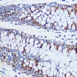 Immunohistochemistry - Anti-TOMM20 Antibody (A15372) - Antibodies.com