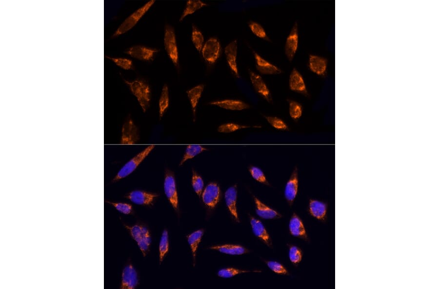 Immunofluorescence - Anti-TOMM20 Antibody (A15372) - Antibodies.com