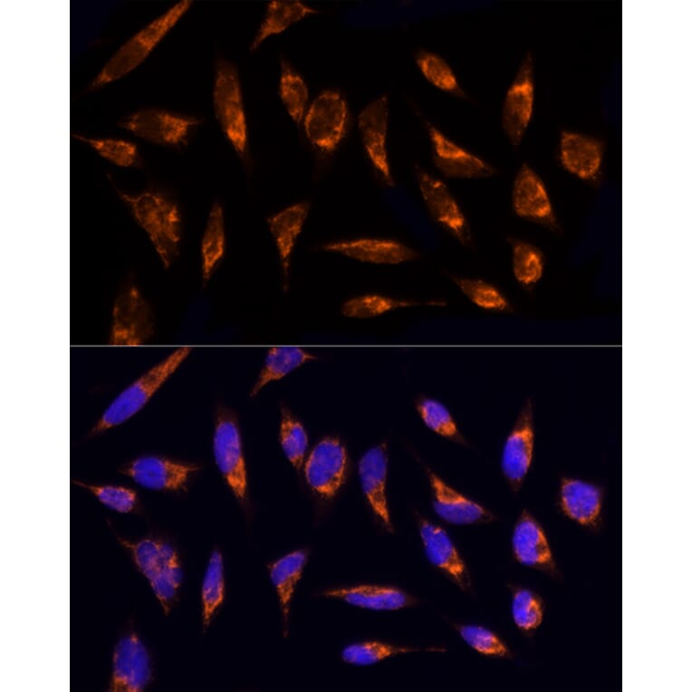 Immunofluorescence - Anti-TOMM20 Antibody (A15372) - Antibodies.com