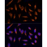 Immunofluorescence - Anti-TOMM20 Antibody (A15372) - Antibodies.com