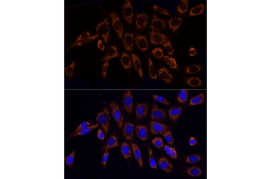 Immunofluorescence - Anti-TOMM20 Antibody (A15372) - Antibodies.com