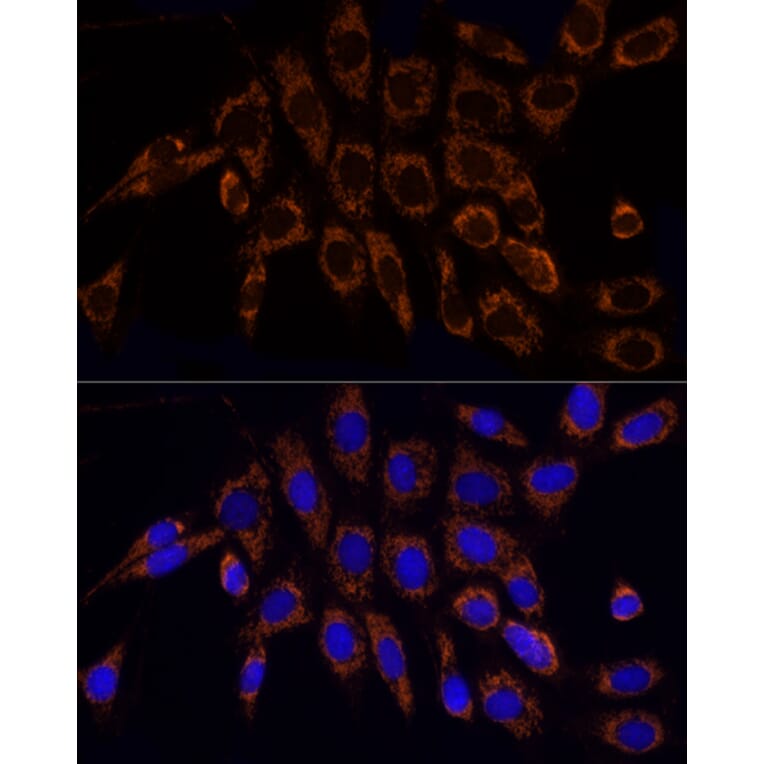 Immunofluorescence - Anti-TOMM20 Antibody (A15372) - Antibodies.com