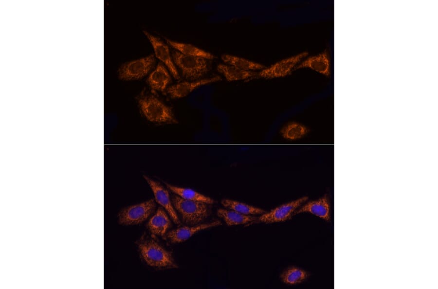 Immunofluorescence - Anti-TOMM20 Antibody (A15372) - Antibodies.com