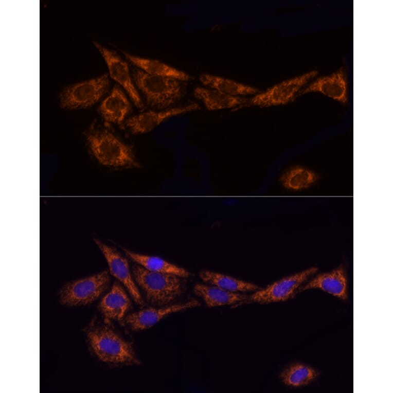 Immunofluorescence - Anti-TOMM20 Antibody (A15372) - Antibodies.com
