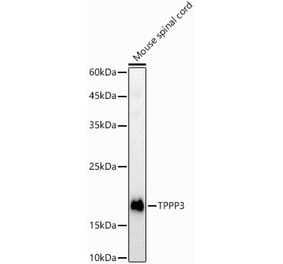Western Blot - Anti-TPPP3 Antibody (A15373) - Antibodies.com