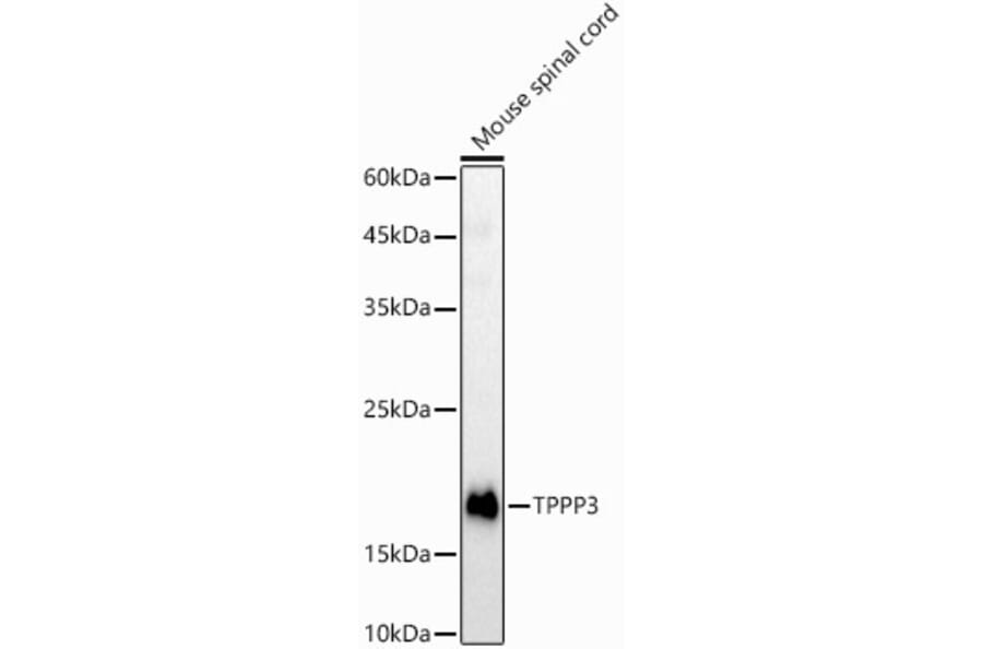 Western Blot - Anti-TPPP3 Antibody (A15373) - Antibodies.com