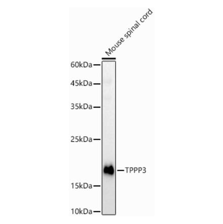 Western Blot - Anti-TPPP3 Antibody (A15373) - Antibodies.com