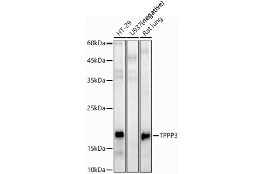 Western Blot - Anti-TPPP3 Antibody (A15373) - Antibodies.com