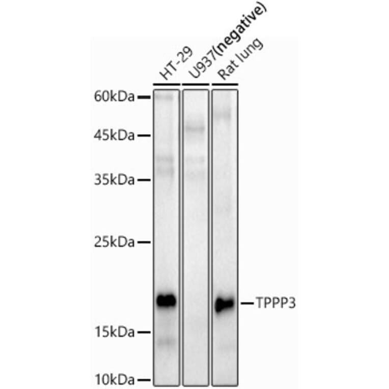 Western Blot - Anti-TPPP3 Antibody (A15373) - Antibodies.com