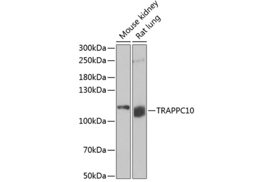 Western Blot - Anti-TRAPPC10 Antibody (A15374) - Antibodies.com