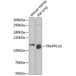 Western Blot - Anti-TRAPPC10 Antibody (A15374) - Antibodies.com