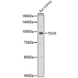 Western Blot - Anti-TSH Receptor/TSH-R Antibody (A15375) - Antibodies.com