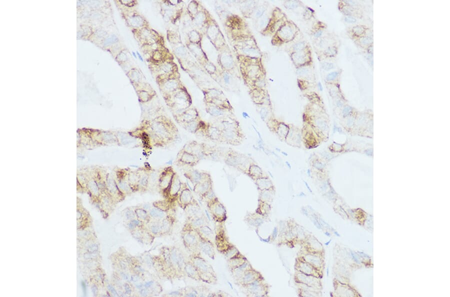 Immunohistochemistry - Anti-TSH Receptor/TSH-R Antibody (A15375) - Antibodies.com