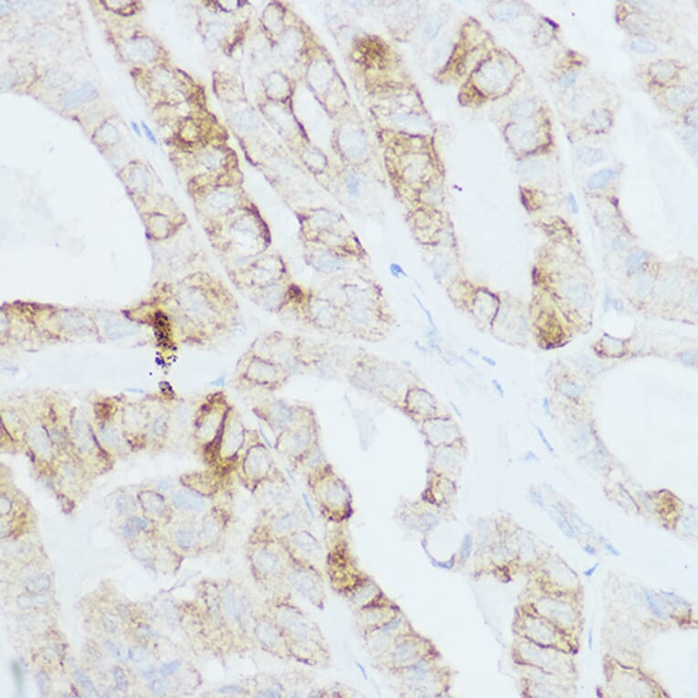 Immunohistochemistry - Anti-TSH Receptor/TSH-R Antibody (A15375) - Antibodies.com