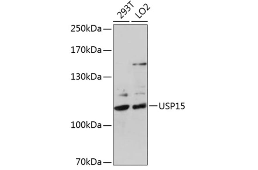 Western Blot - Anti-USP15 Antibody (A15379) - Antibodies.com