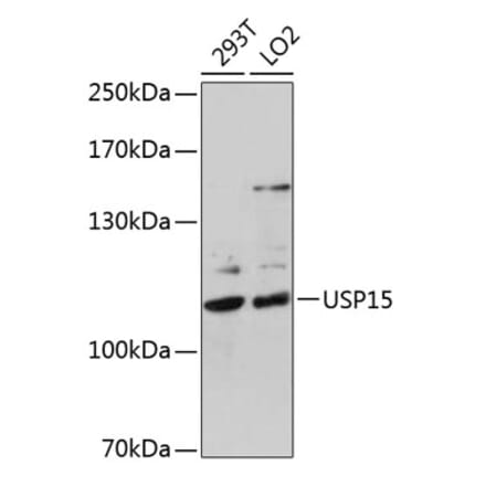 Western Blot - Anti-USP15 Antibody (A15379) - Antibodies.com