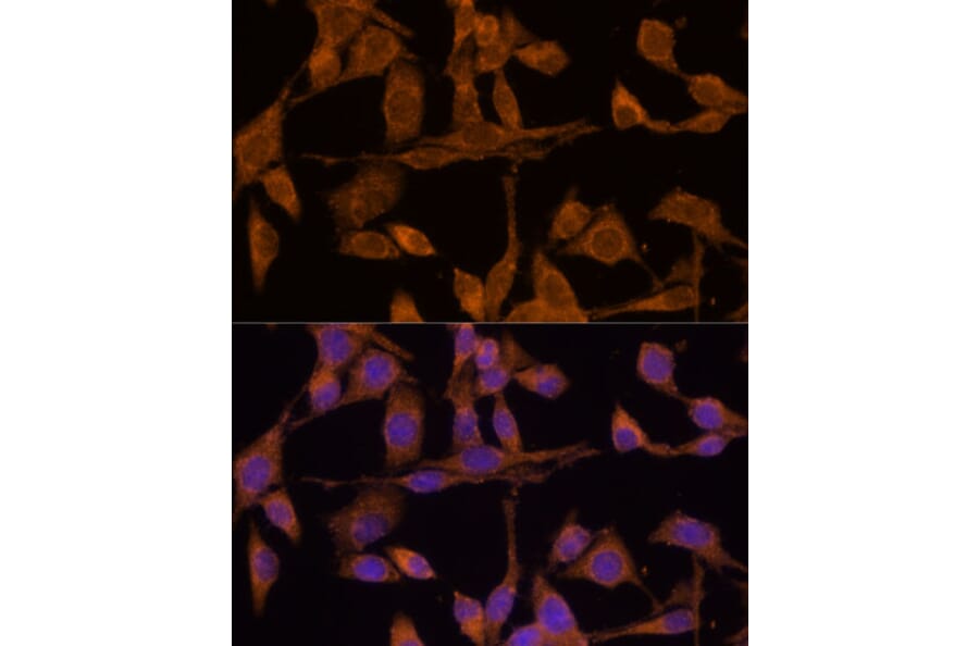 Immunofluorescence - Anti-USP15 Antibody (A15379) - Antibodies.com