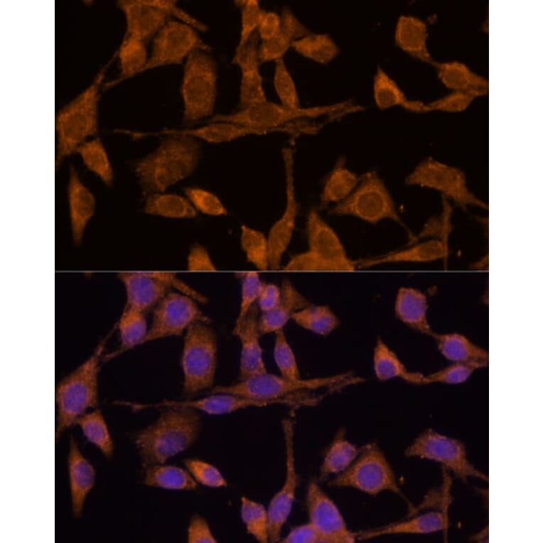 Immunofluorescence - Anti-USP15 Antibody (A15379) - Antibodies.com