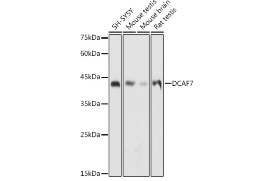 Western Blot - Anti-WDR68 Antibody (A15380) - Antibodies.com
