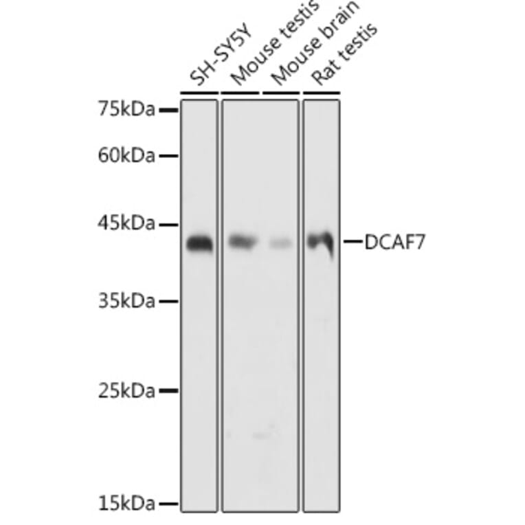 Western Blot - Anti-WDR68 Antibody (A15380) - Antibodies.com