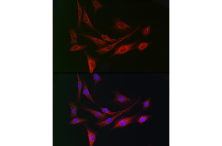 Immunofluorescence - Anti-WDR68 Antibody (A15380) - Antibodies.com
