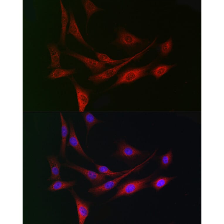 Immunofluorescence - Anti-WDR68 Antibody (A15380) - Antibodies.com