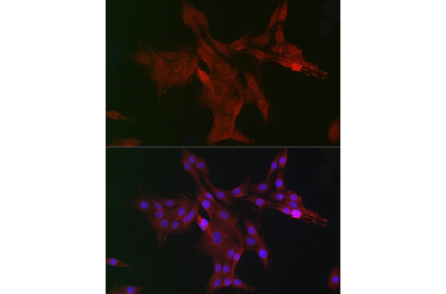 Immunofluorescence - Anti-WDR68 Antibody (A15380) - Antibodies.com