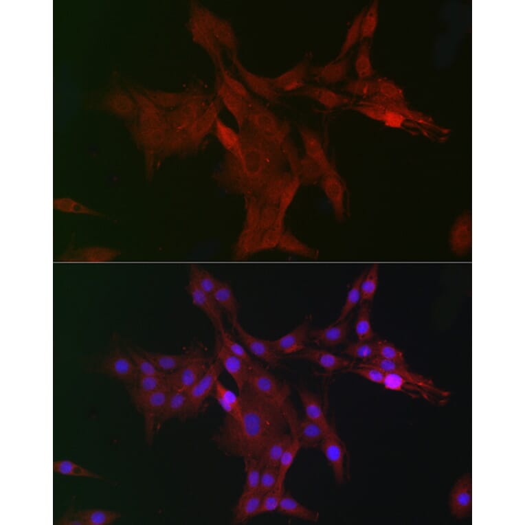 Immunofluorescence - Anti-WDR68 Antibody (A15380) - Antibodies.com