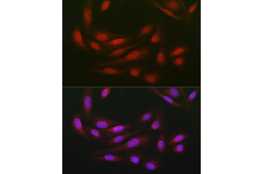 Immunofluorescence - Anti-WDR68 Antibody (A15380) - Antibodies.com
