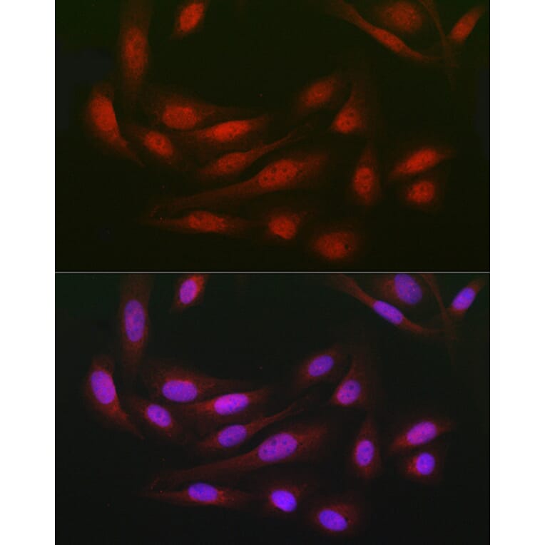 Immunofluorescence - Anti-WDR68 Antibody (A15380) - Antibodies.com