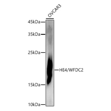Western Blot - Anti-HE4 Antibody (A15381) - Antibodies.com