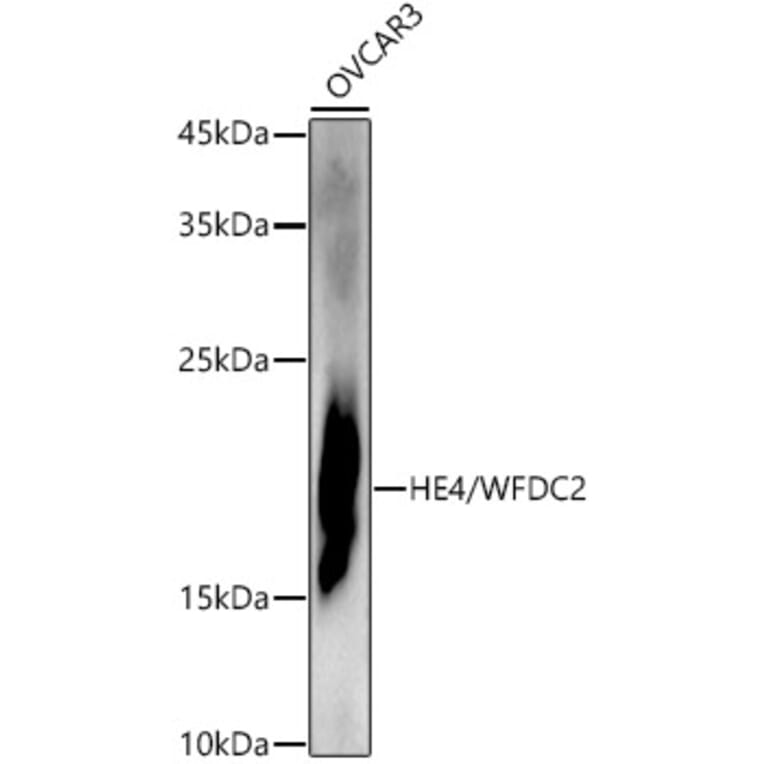 Western Blot - Anti-HE4 Antibody (A15381) - Antibodies.com