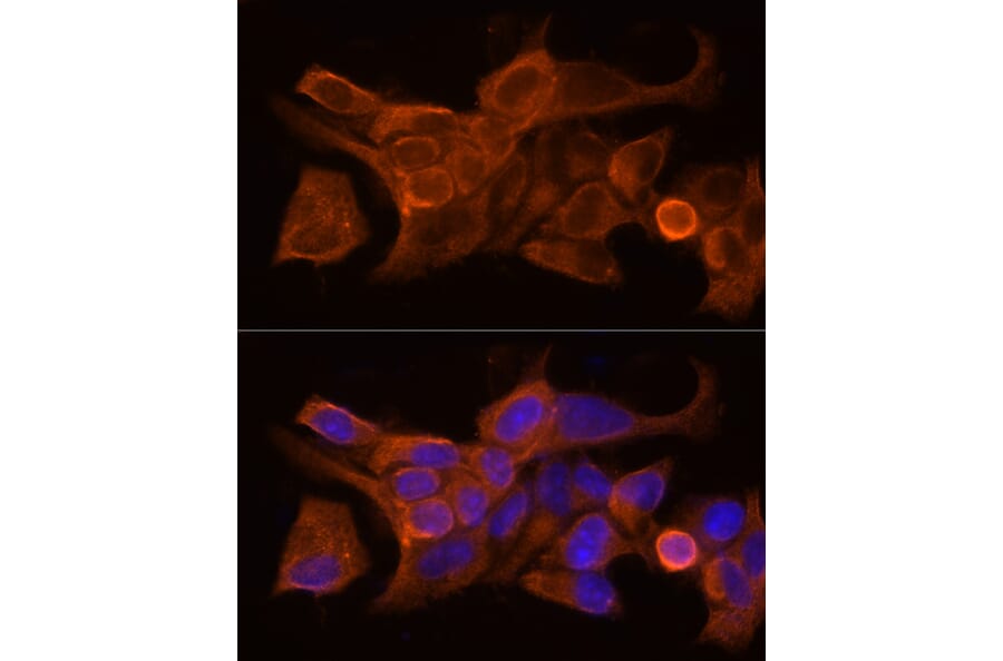Immunofluorescence - Anti-HE4 Antibody (A15381) - Antibodies.com