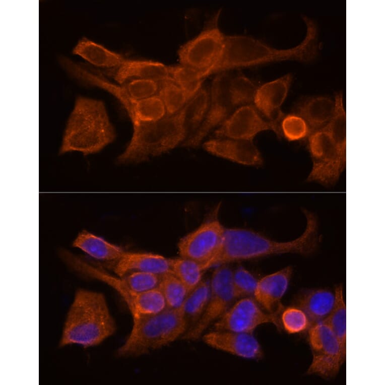 Immunofluorescence - Anti-HE4 Antibody (A15381) - Antibodies.com