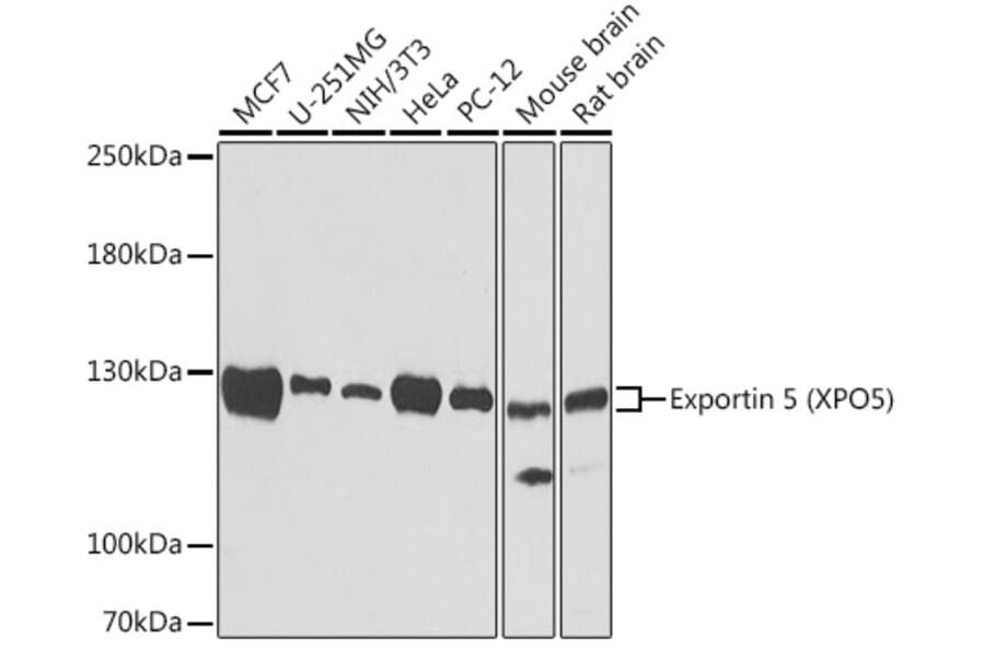 Western Blot - Anti-Exportin-5 Antibody (A15382) - Antibodies.com