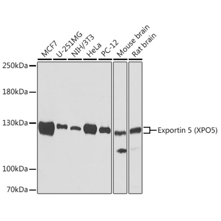 Western Blot - Anti-Exportin-5 Antibody (A15382) - Antibodies.com